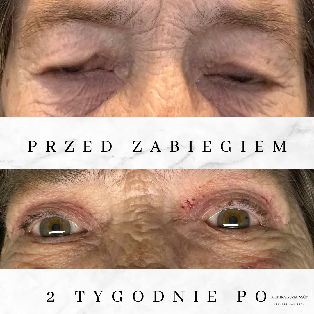 Zdjęcie 10